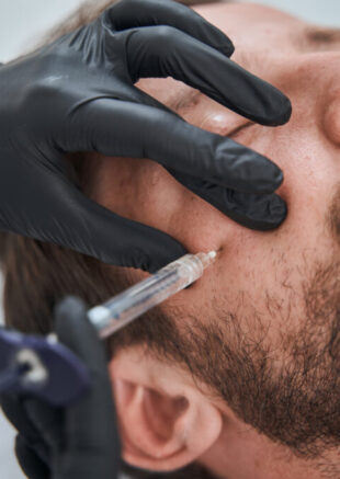 Caucasian male patient undergoing a mesotherapy procedure